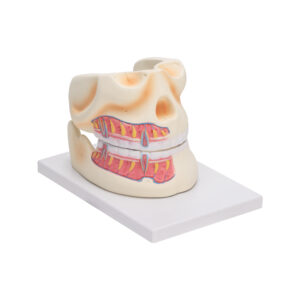 HUMAN UPPER & LOWER JAW