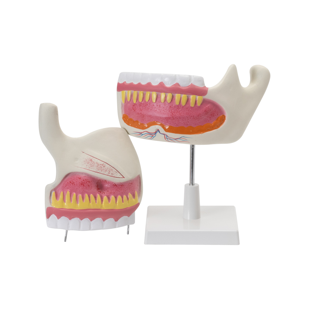 HUMAN UPPER & LOWER JAW - Image 2