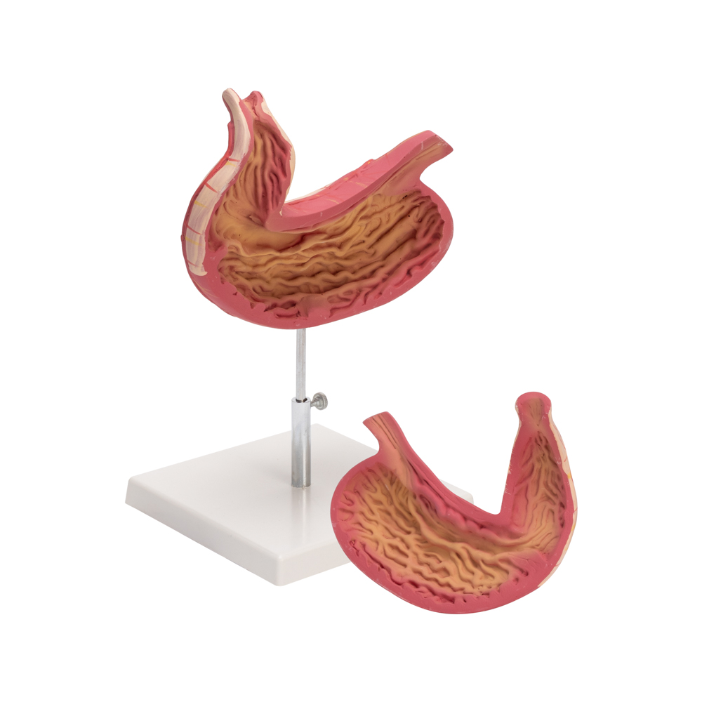 HUMAN STOMACH - Image 3