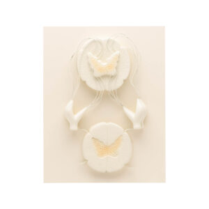 HUMAN SPINAL CORD MODEL-10 TIMES ENLARGED