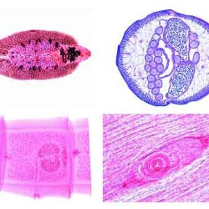 Arthropoda (Insecta)