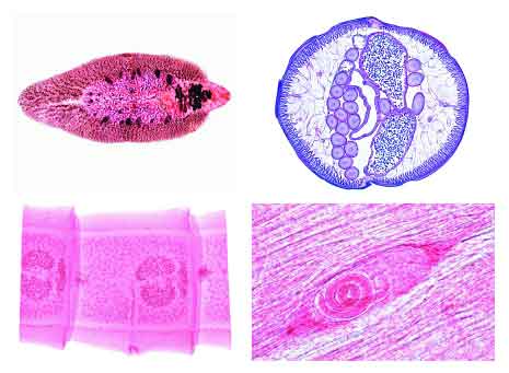 Arthropoda (Insecta)